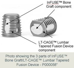 InFUSE Bone graft diagram